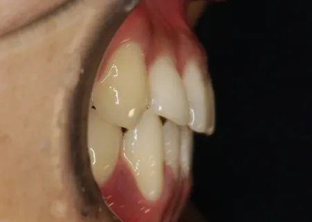 治療後