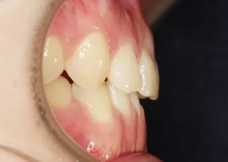 治療後